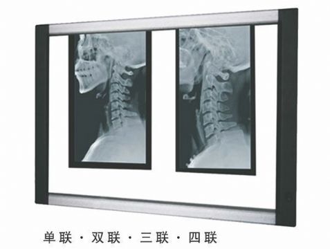 點擊查看詳細信息<br>標題：LED觀片燈 閱讀次數：2710